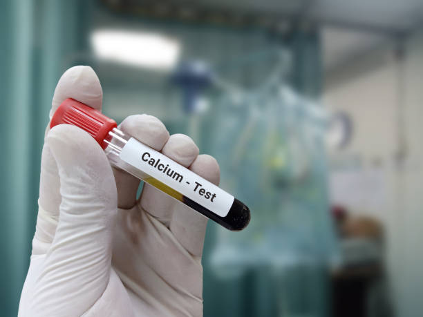 Calcium Test 