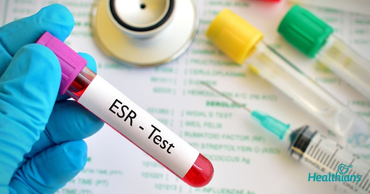 ESR Test 